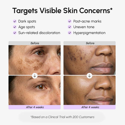 Face & Body Serum for Dark Spots